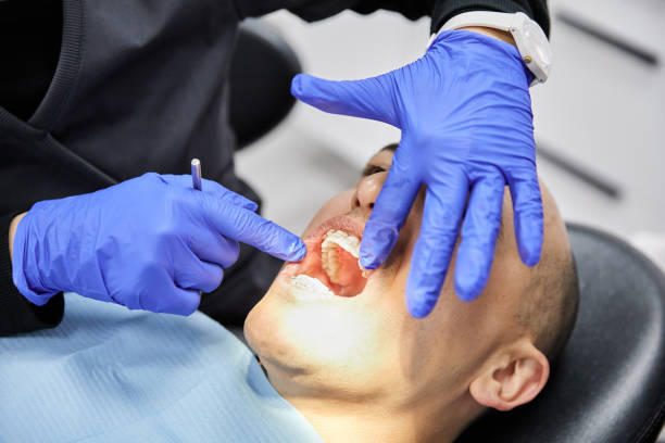 Best Emergency Dental Care for Broken or Chipped Teeth in Shell Ridge, CA