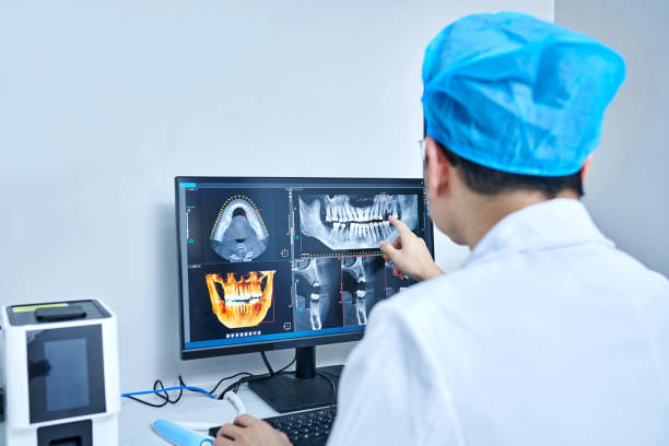 Best Emergency Root Canal Treatment in Shell Ridge, CA