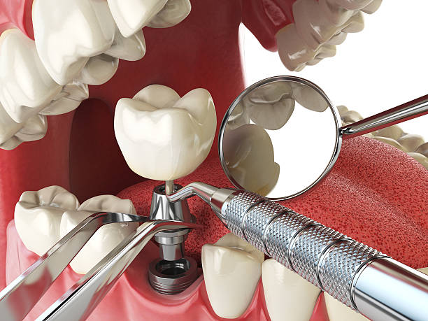 Best Weekend Emergency Dentist in Shell Ridge, CA