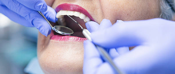 Best Cosmetic Emergency Dentistry in Shell Ridge, CA